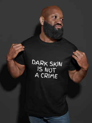 Dark Skin Is Not A Crime Black Lives Matter Shirt - Funny Labrador Cute Shirt Labradors Labs